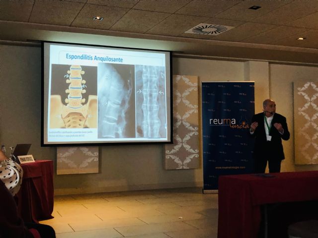 Cartagena acogerá este fin de semana el XI Congreso de la Sociedad Murciana de Reumatología